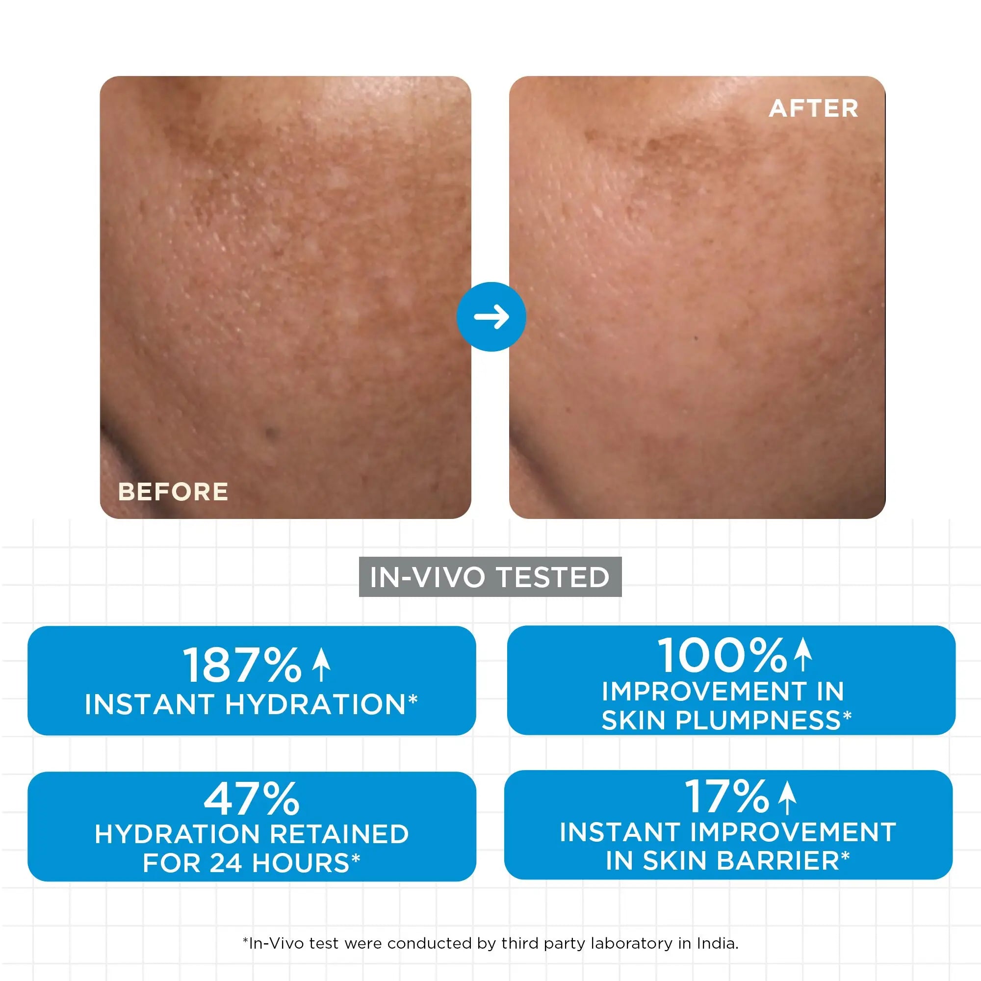 SkinQ Hydrate & Nourish Mask 10g (Pack of 5) - view 10