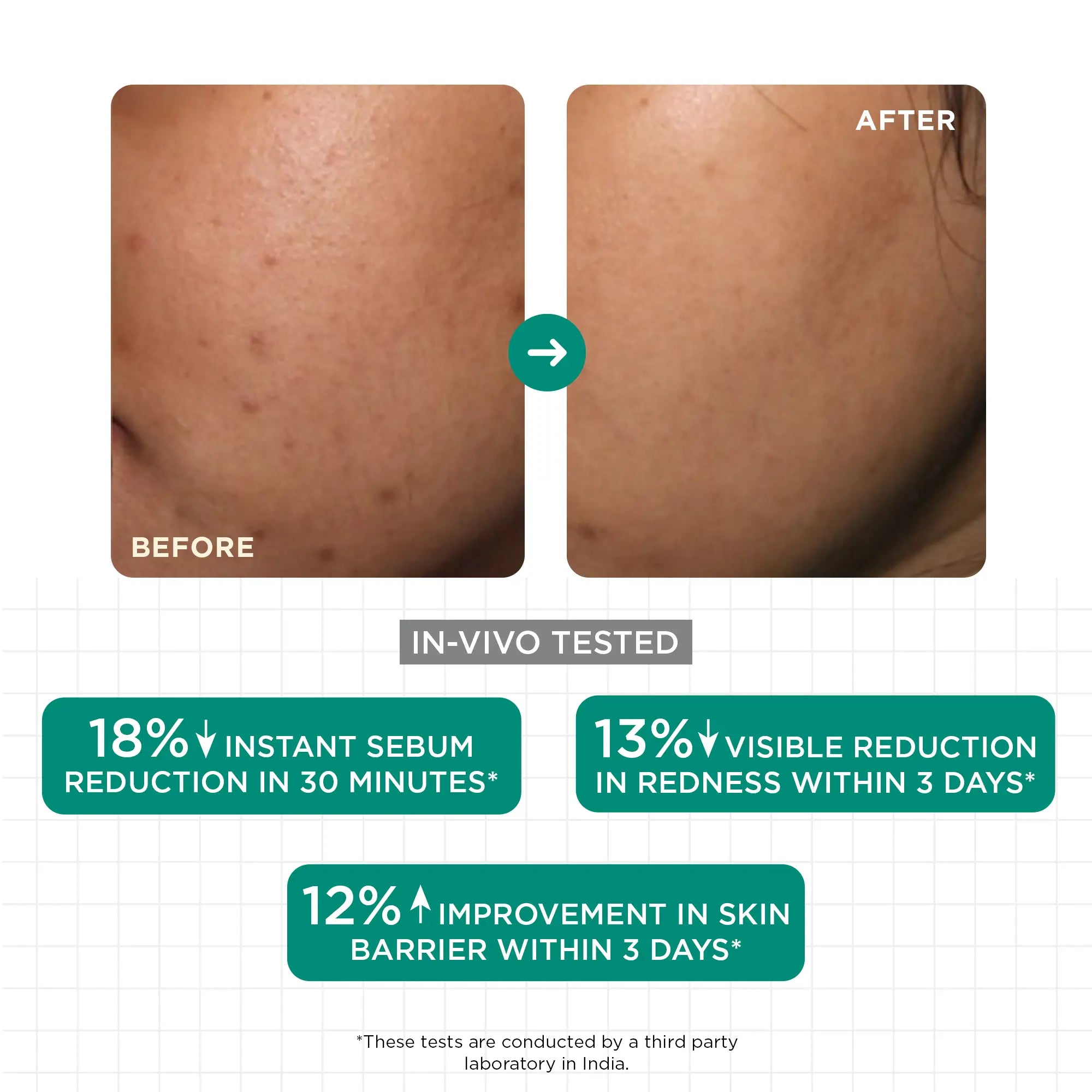 SkinQ Acne & Oil Control Serum 30ml - view 9