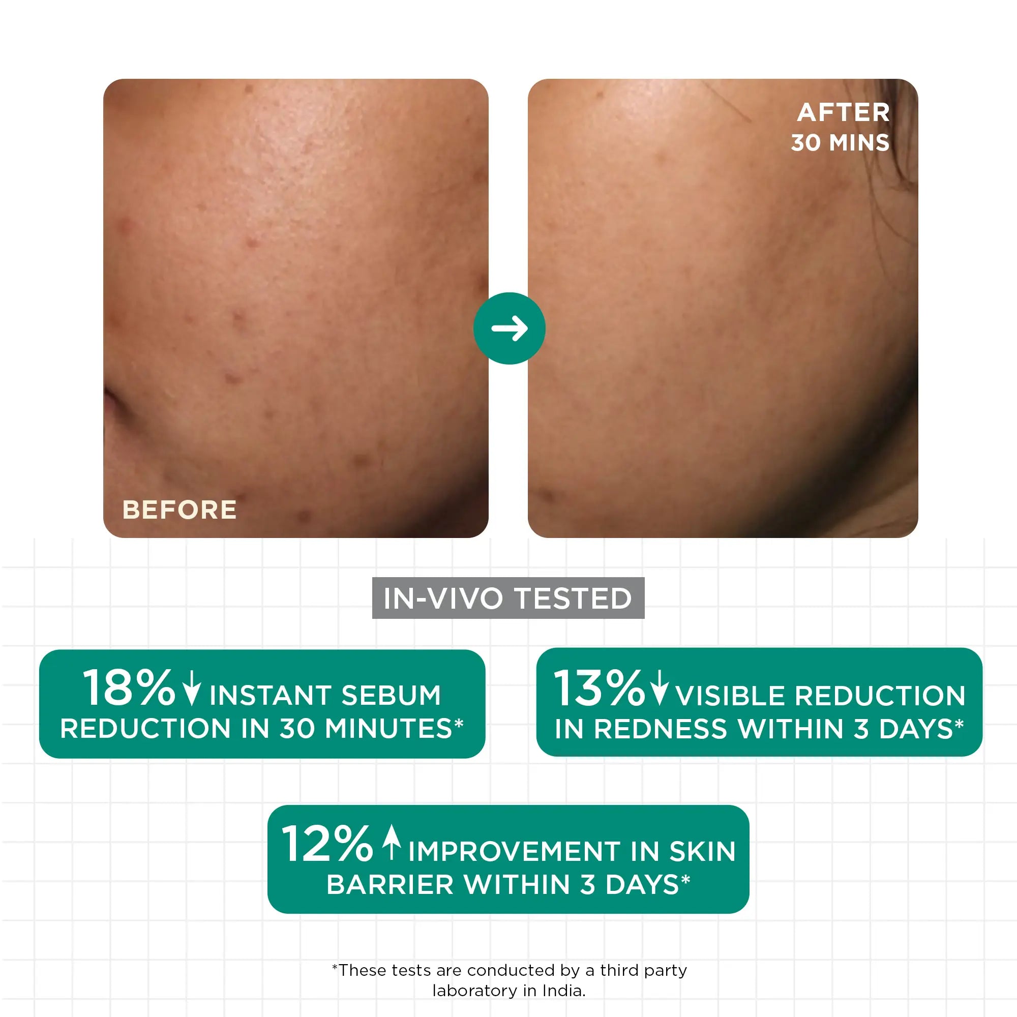 SkinQ Acne & Oil Control Serum 30ml - view 7