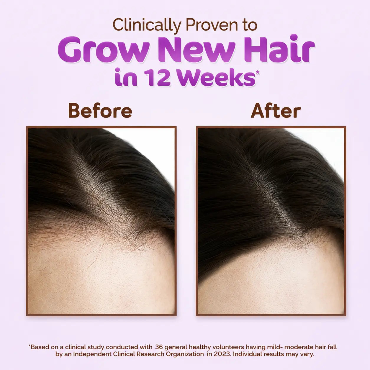 Mamaearth Rosemary Hair Oil 150ml - view 4
